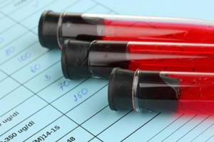 m_bigstock-Blood-in-test-tubes-and-result-43109644